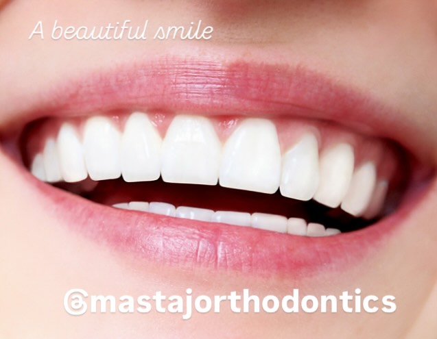 Why Invisalign in Bryn Mawr PA Is a Popular Choice for Confident Smiles