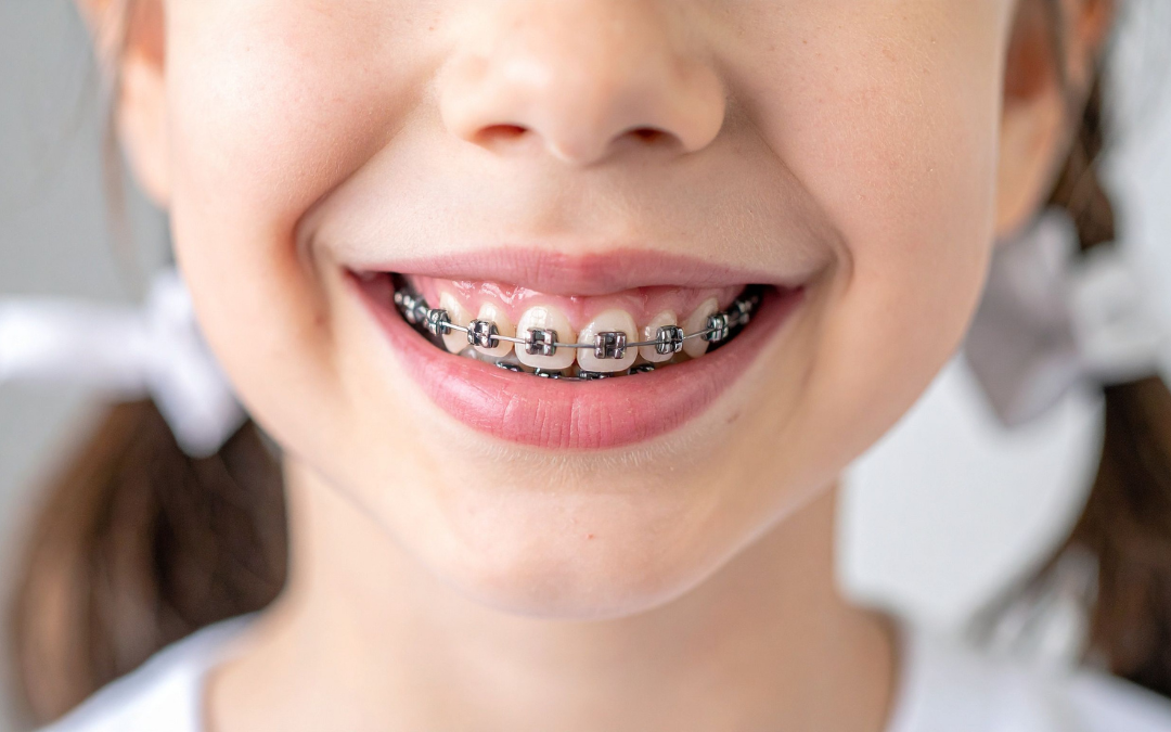 When Should Your Child See an Orthodontist_ A Parent’s Guide to Early Orthodontic Care in Bryn Mawr, PA